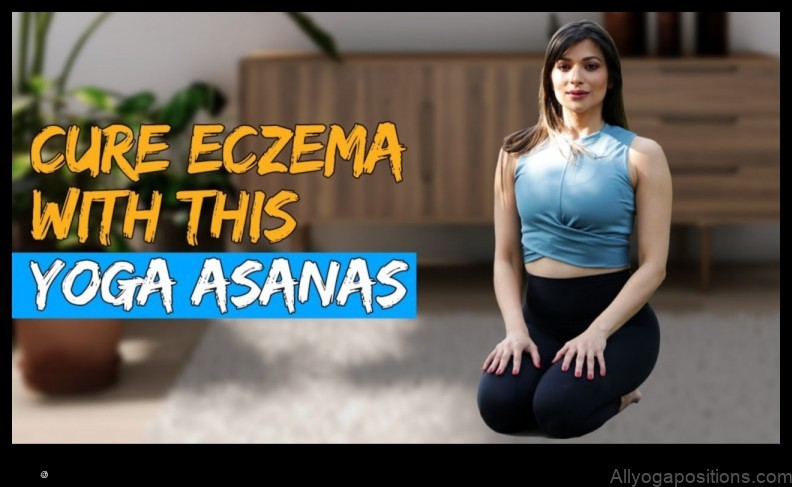 Yoga for Eczema Relief